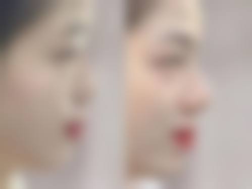 拉萨新丽澳医疗美容诊所实例参考