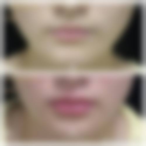 郑州屈秋芳整形医院怎么预约？