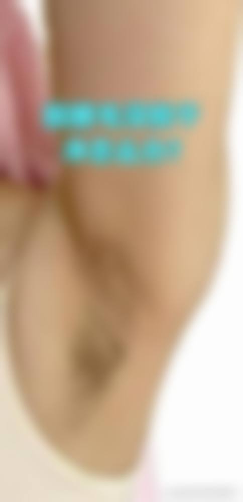 朴成奕患者评价