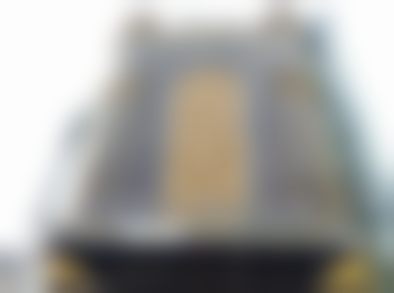 台州艺星医美整形医院（口腔正畸科）实例参考