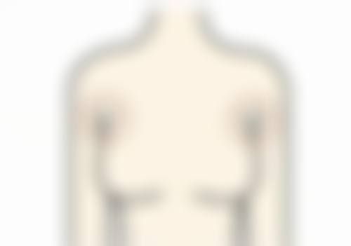 佛山和美家妇产医院私密整形实例参考