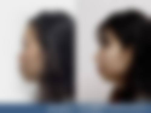 久留米Elm诊所怎么预约？