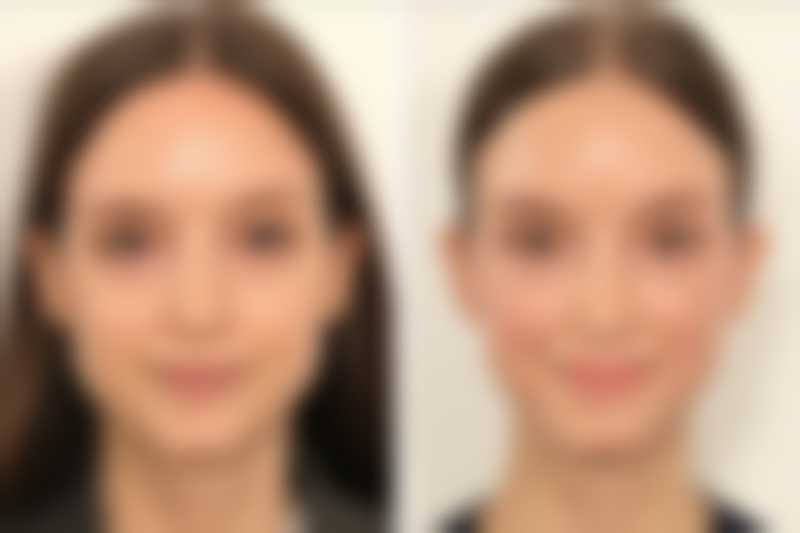 赵云慧预约方式