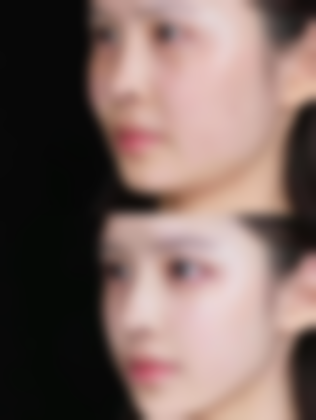 永州瑞澜医疗美容医院价格表（仅供参考）