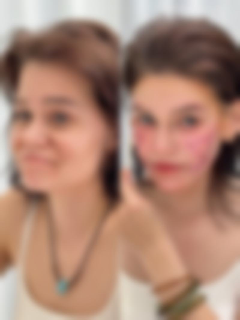 临汾美妍整形医院怎么预约？