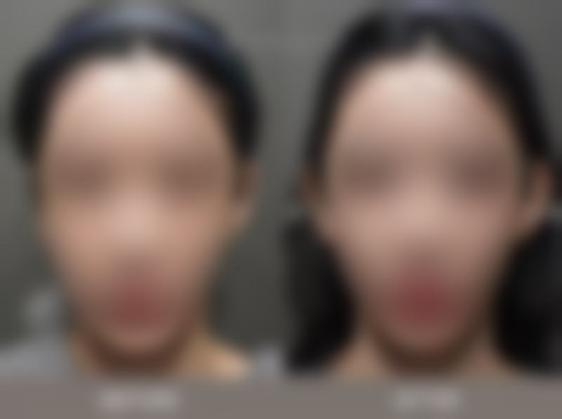 永州瑞澜医疗美容医院怎么预约？