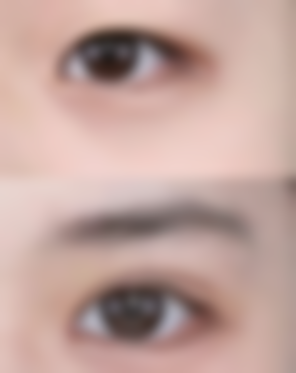 威海星芙妍华发新天地医疗美容诊所实例参考