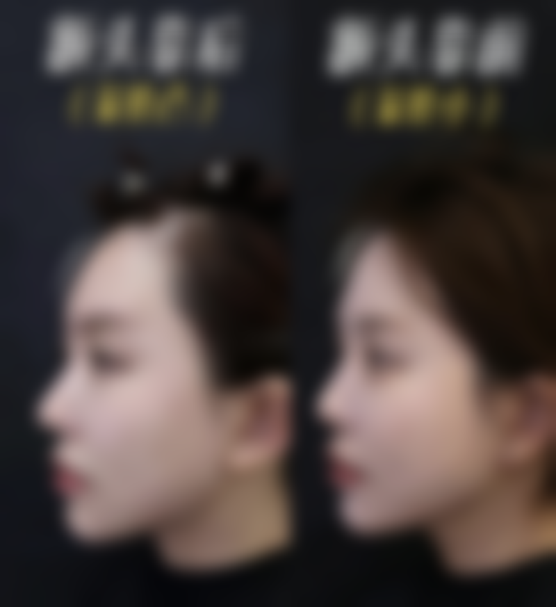 龚佳胜预约方式