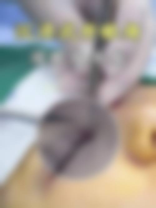 大同清木医疗美容医院正规吗？看资质