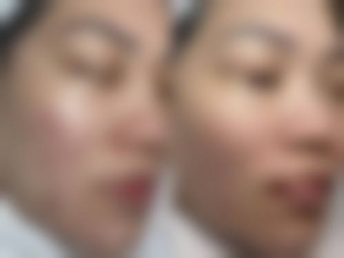 红妆医学美容核心项目