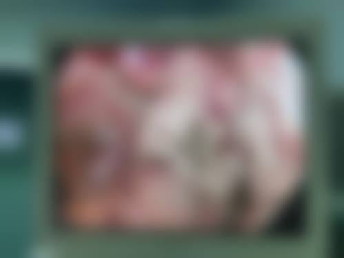 大同清木医疗美容医院实例参考