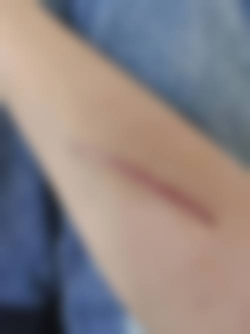 大同清木医疗美容医院核心项目