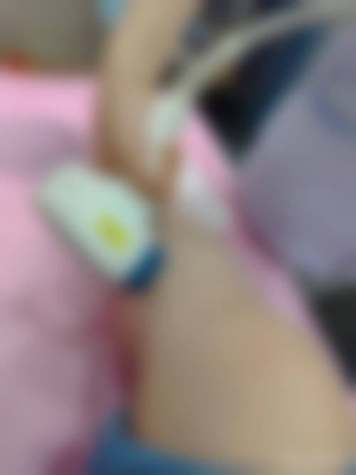 韩国精细美研（Pinpoint Lab SMP）医院实例参考