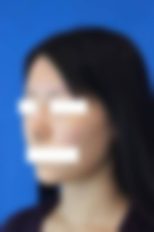 上海韩春民整形医院价格表（仅供参考）