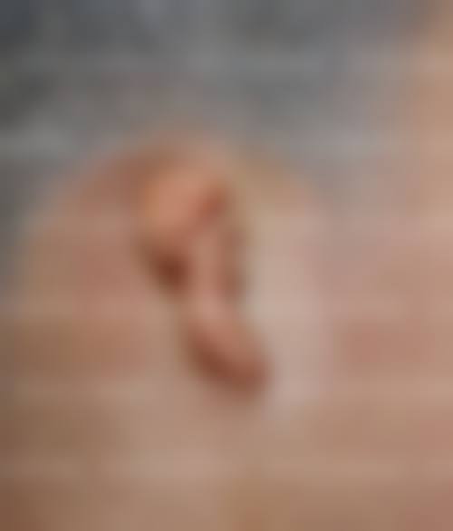 河北北方学院附属前列医院实例参考