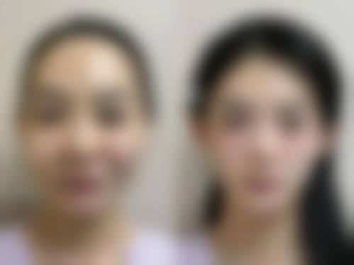 红妆医学美容价格表（仅供参考）