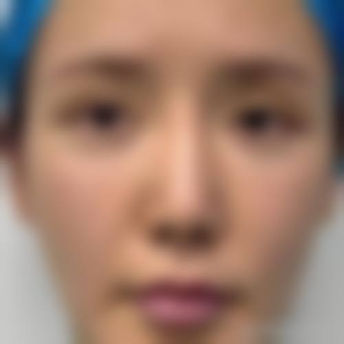 昆明丽都仁爱整形美容医院实例参考