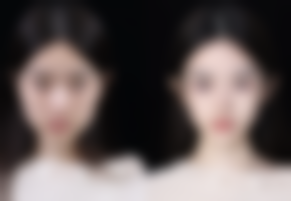 怀化市第二人民医院整形美容科核心项目