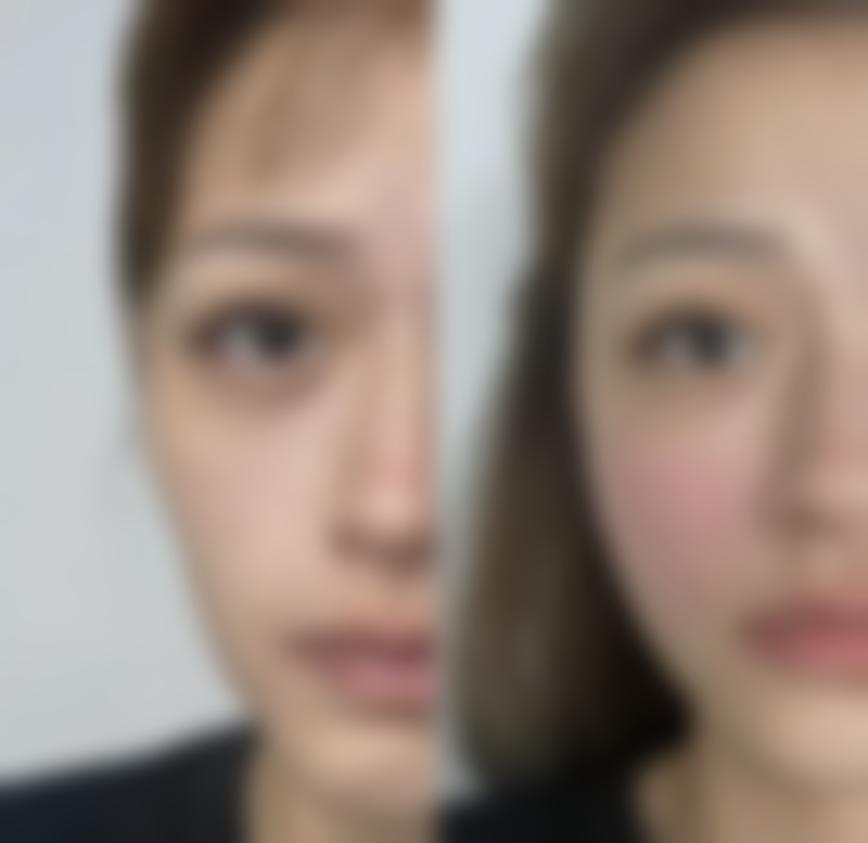 红妆医学美容实例参考