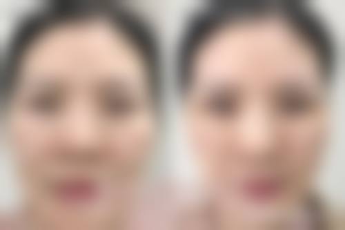 包头博美雅医疗美容门诊部怎么预约？