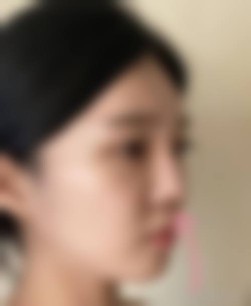 重庆中民耳鼻喉医院中民整形外科价格表（仅供参考）