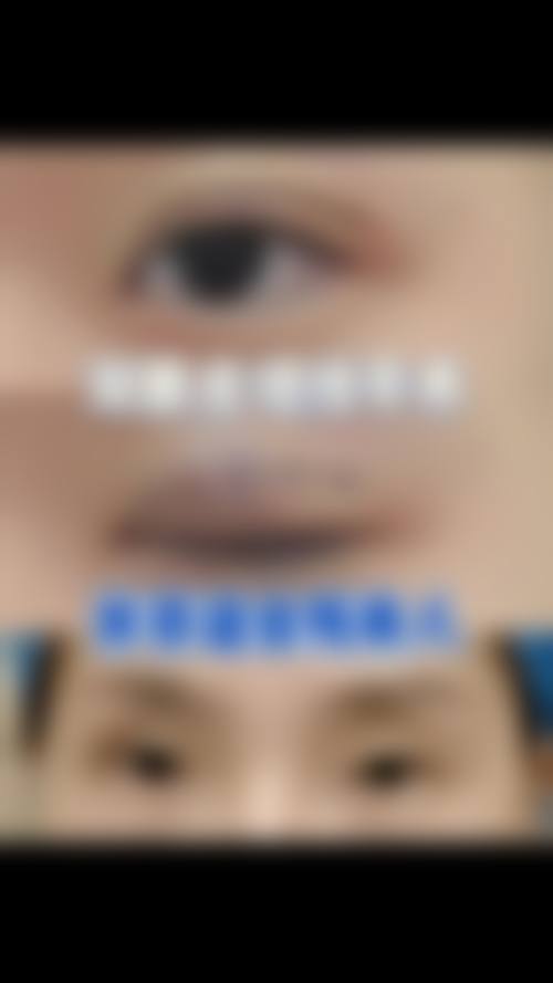 青岛市第五人民医院整形美容科价格表(仅供参考)