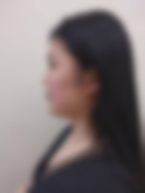 宁波科妃医疗美容诊所价格表（仅供参考）