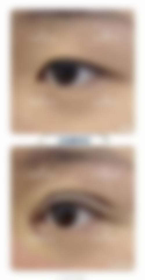 赵云慧擅长项目列表