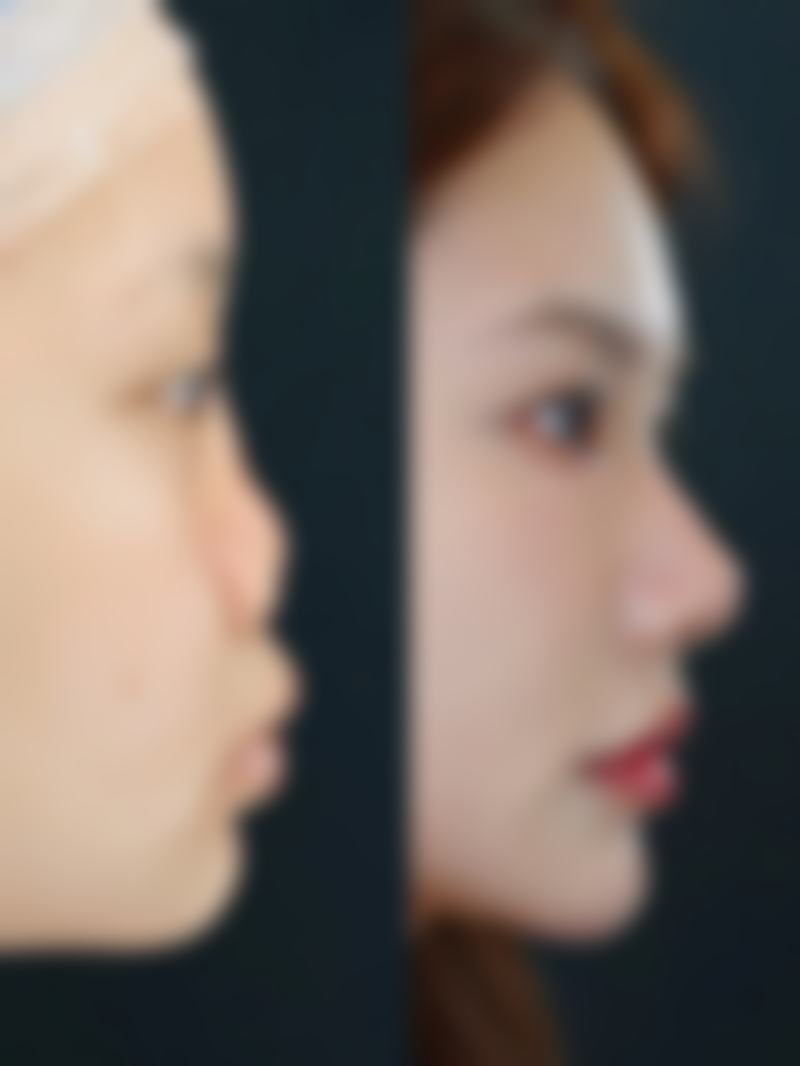 尹又阶擅长项目列表