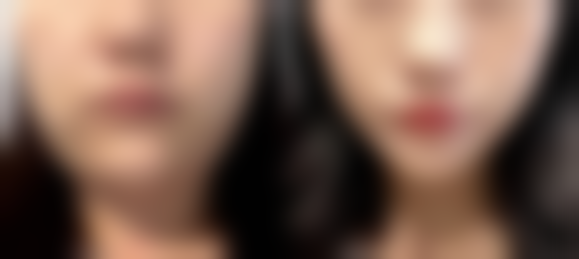 北京熙朵医疗美容国内外连锁机构怎么预约？