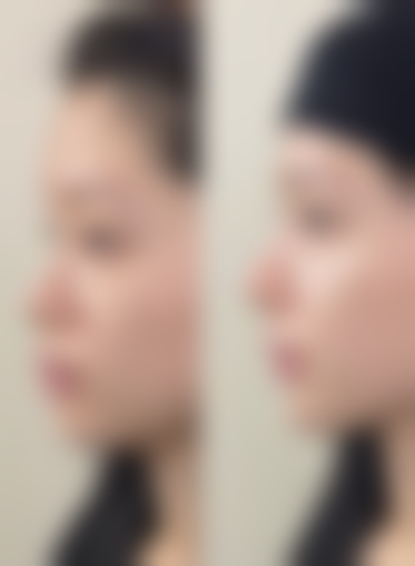 三明市梅列区医院整形科正规吗?看资质