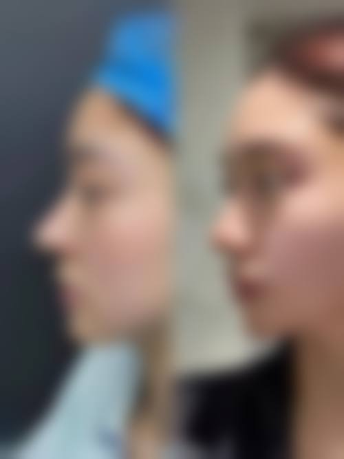 南京金陵嘉怡美医疗美容(脂肪专科)价格表(仅供参考)