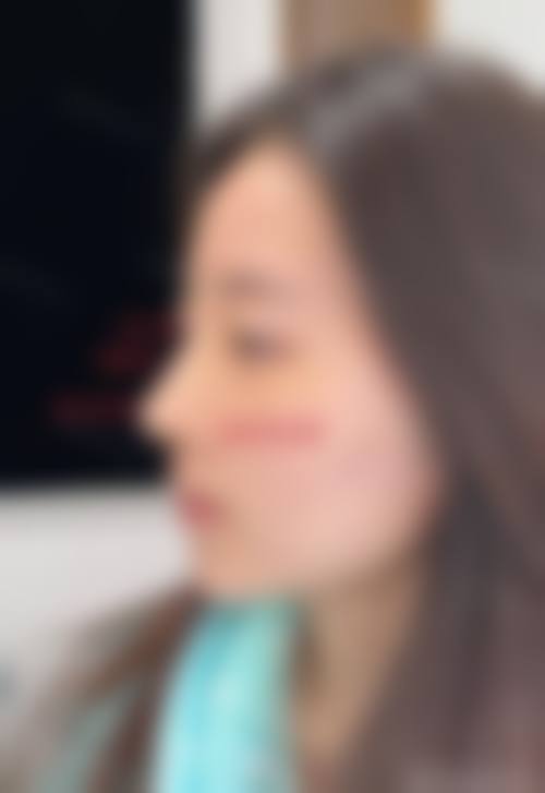 南京金陵嘉怡美医疗美容(脂肪专科)实例参考