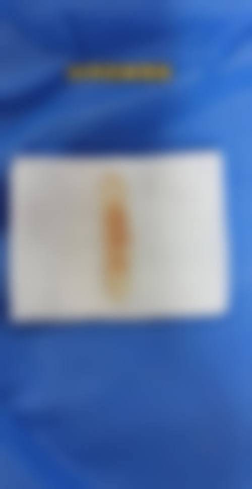 遂宁伊莎贝拉医学美容整形医院怎么预约?