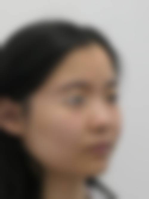 成都锦江美欣医疗美容门诊部价格表(仅供参考)