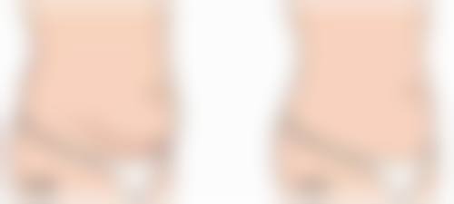 南昌柠檬一美医疗美容诊所怎么预约?