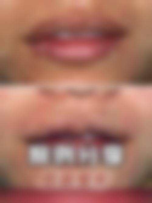 三门峡仝金成医疗美容诊所实例参考