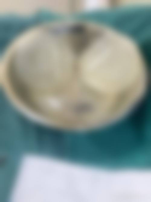 东莞市南城医院怎么预约?