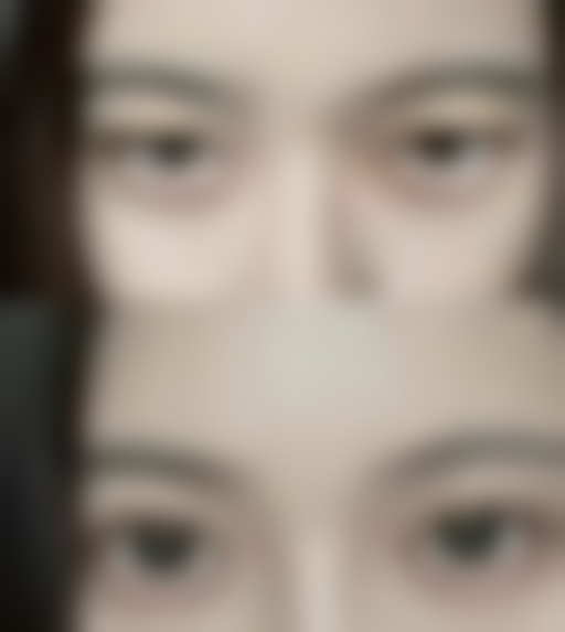 福州姚文华整形医院实例参考