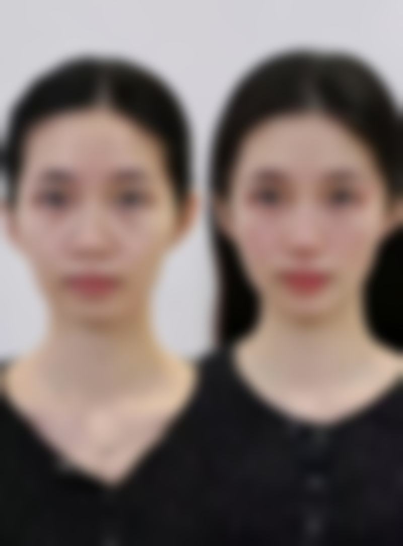 衡阳微美医疗美容诊所正规吗？看资质