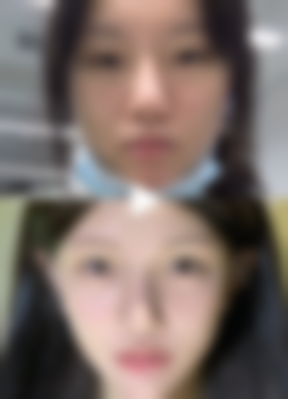 贵阳悦程妇幼医院医疗美容科实例参考