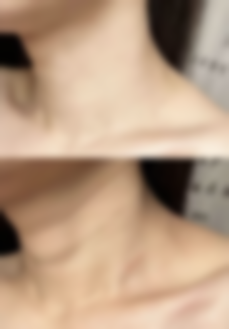 佛山天笙整形医院怎么预约?