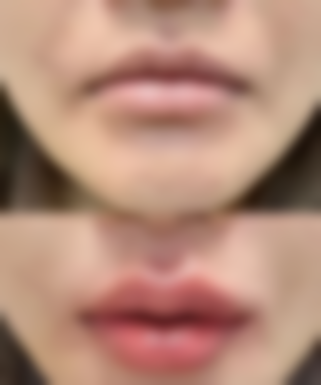 三门峡仝金成医疗美容诊所怎么预约?