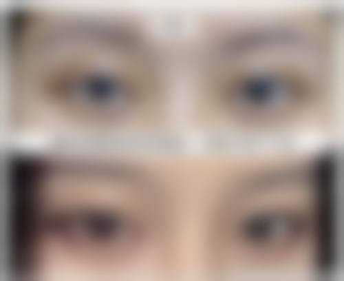 郑州花绽医疗美容诊所实例参考