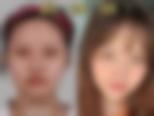 重庆曙光整形美容门诊部怎么预约?