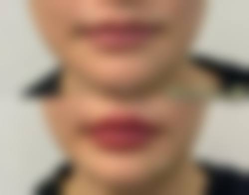 宁海伊颜整形医院实例参考