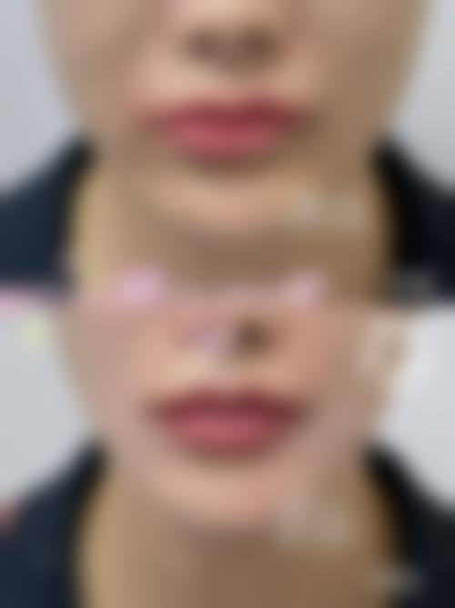 深圳艾薇感光整形医院核心项目