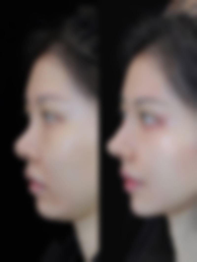 姜广霞患者评价