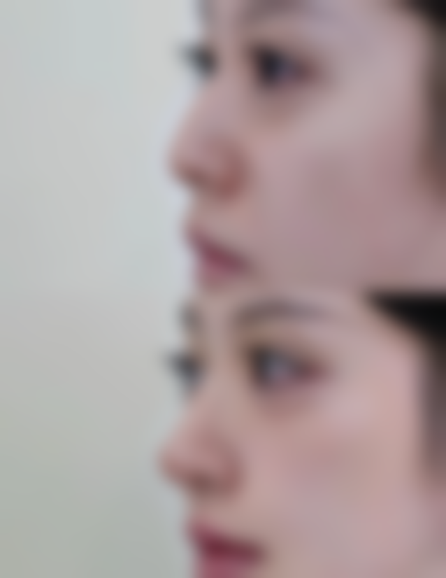 曾兴银擅长项目列表