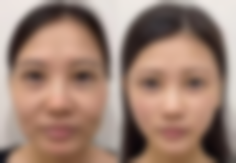 深圳艾薇感光整形医院怎么预约?